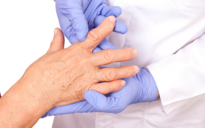 Nguyên nhân và phác đồ điều trị viêm khớp dạng thấp