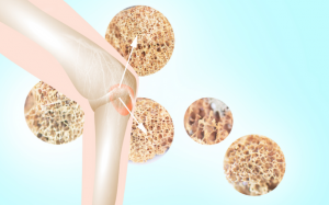 Những dấu hiệu cho thấy cơ thể bạn đang thiếu calci