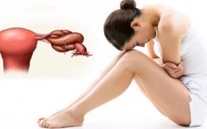 Những điều cần biết về u nang buồng trứng xoắn