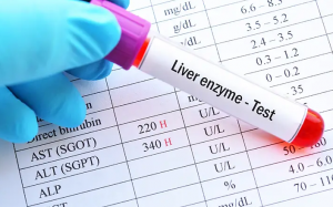 Cách hạ men gan ALT tự nhiên và hiệu quả