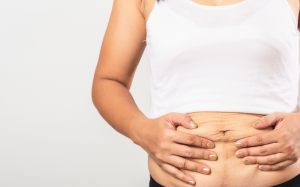 Mẹo ngăn ngừa và cải thiện da chảy xệ sau giảm cân