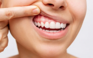 Mẹo giúp nướu khỏe mạnh