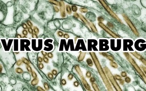 Bệnh do virus Marburg: Triệu chứng, nguyên nhân, điều trị thế nào?