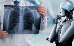 Trí tuệ nhân tạo giúp phát hiện ung thư phổi sớm?