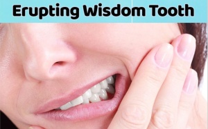 5 dấu hiệu bạn sắp mọc răng khôn