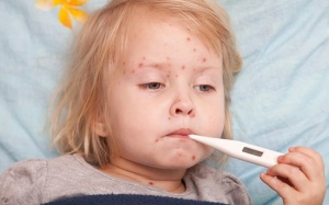 Bệnh thủy đậu có nguy hiểm không?