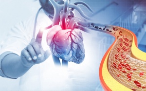 Đặt stent sau bao lâu phải chụp lại mạch vành?