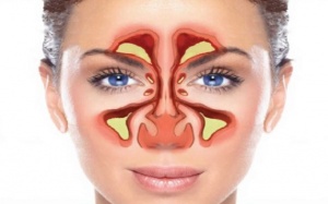 Những lầm tưởng phổ biến về xoang