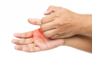 Ngứa lòng bàn tay do đâu?