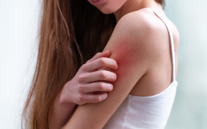 Nguyên nhân tiềm ẩn gây ngứa toàn thân