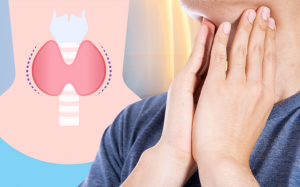 Nguyên nhân gây u tuyến giáp và giải pháp cải thiện bệnh