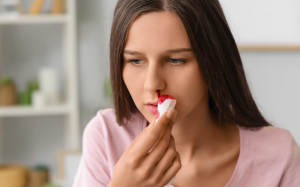 Vì sao chảy máu cam gia tăng vào mùa Hè?