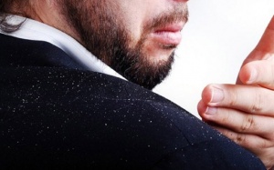 Xóa tan nỗi lo về gàu với những cách đơn giản