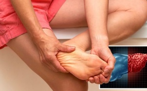 Dấu hiệu ở bàn chân cho thấy vấn đề về gan