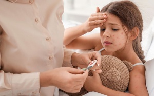 Cách xử trí phỏng nước do thủy đậu