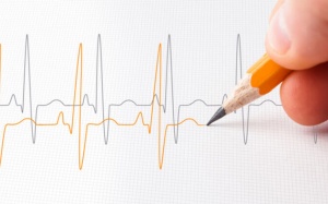 Cảm giác tim ngừng đập vài giây là bị bệnh gì? 