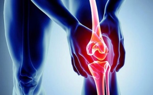 Dấu hiệu cảnh báo bệnh thoái hóa khớp gối và cách phòng ngừa bệnh