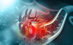 Bị bệnh mạch vành, mỡ máu, uống thuốc ổn định rồi ngừng được không?