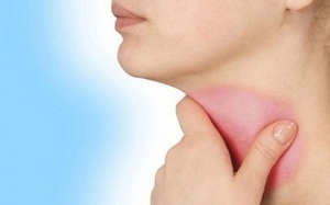 Nhận biết sớm 4 dấu hiệu u tuyến giáp để can thiệp kịp thời