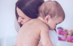 Hà Nội tập trung phòng, chống dịch bệnh mùa Hè