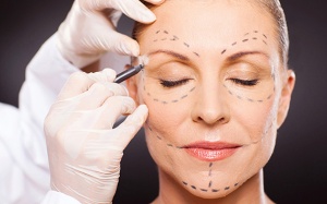 Lưu ý khi phẫu thuật thẩm mỹ ở tuổi trung niên
