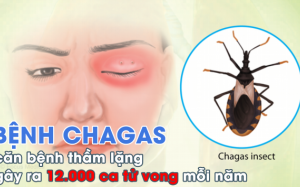 Bệnh Chagas: Căn bệnh thầm lặng gây ra 12.000 ca tử vong mỗi năm