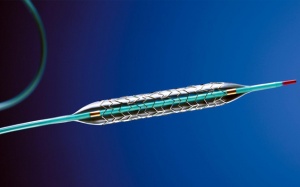 Tắc hẹp mạch vành: Phương pháp đặt stent có những rủi ro nào?