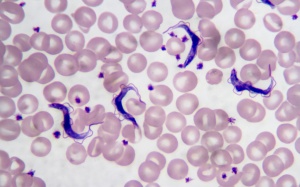 Chagas - 'Căn bệnh thầm lặng' đáng sợ lây lan từ ký sinh trùng