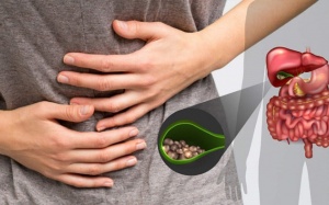 Bị sỏi túi mật 4mm nên điều trị thế nào?