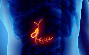 Hỏi - đáp về sỏi túi mật 22mm