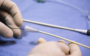 Đặt stent điều trị bệnh mạch vành có thể gặp phải những rủi ro gì?