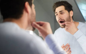  Bệnh đái tháo đường: Chú ý triệu chứng ở miệng