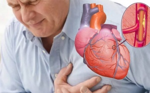 Bị thiếu máu cơ tim có thể sống được bao lâu?