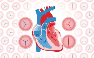 Dấu hiệu cảnh báo giúp phát hiện sớm hở van tim do hậu thấp