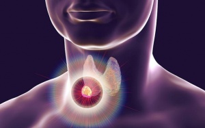 Cắt bỏ tuyến giáp có ảnh hưởng gì tới sức khỏe?