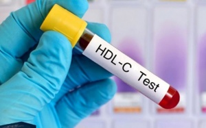 3 cách đơn giản giúp tăng cholesterol tốt