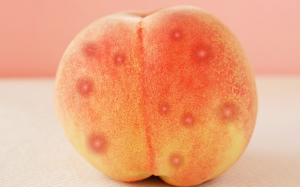 Cách ngăn ngừa và loại bỏ mụn nhọt ở mông tại nhà