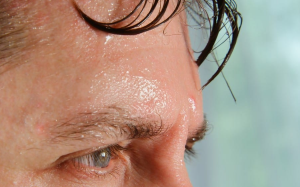 Tại sao đổ nhiều mồ hôi ở mặt và cách cải thiện?