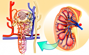 Ngăn ngừa biến chứng suy thận độ 3 như thế nào?