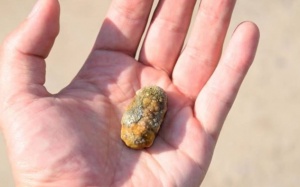 Sau mổ cắt túi mật có dùng TPBVSK Kim Đởm Khang được không?