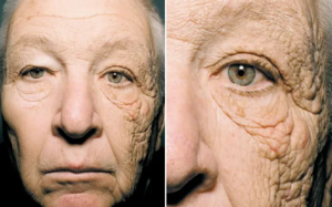 Hai nửa khuôn mặt khác biệt sau 28 năm tiếp xúc với ánh nắng mặt trời