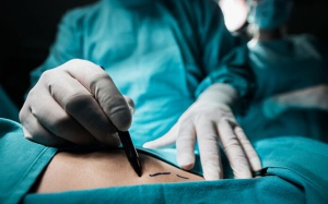 Livestream ca phẫu thuật thẩm mỹ, bác sỹ người Mỹ bị cấm hành nghề