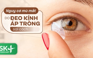 Podcast: Nguy cơ mù mắt do đeo kính áp tròng sai cách