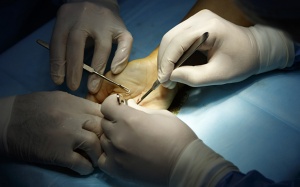 Bệnh viện Đại học Y Hà Nội phẫu thuật cứu bàn tay dập nát