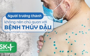 Podcast: Người trưởng thành không nên chủ quan với bệnh thủy đậu