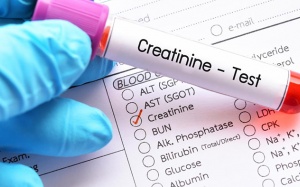 Chỉ số creatinine cảnh báo suy giảm chức năng thận