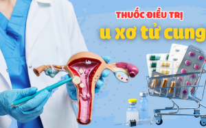 Tìm hiểu về các loại thuốc điều trị u xơ tử cung hiện nay 