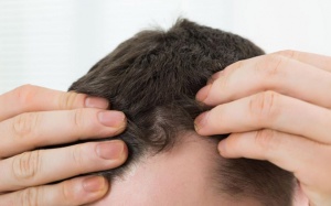 Infographic: Các cách khắc phục tình trạng tóc mỏng và thưa