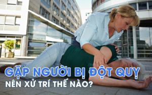 Nên làm gì khi phát hiện người có triệu chứng đột quỵ