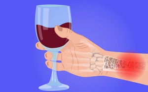 4 nhóm thực phẩm, đồ uống làm tăng nguy cơ loãng xương